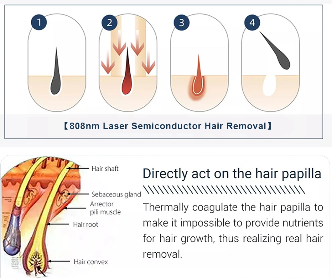 Portable Picosecond Laser Machine Tattoo Remove Equipment Switched Carbon Laser Peel Device